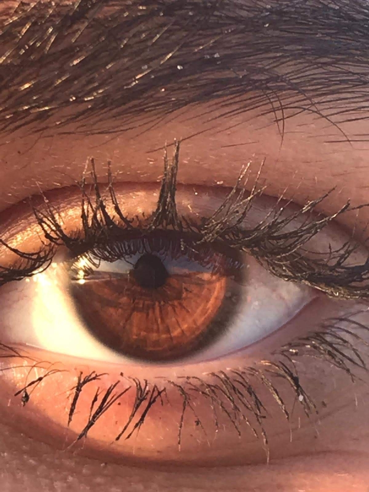 Золотистый цвет глаз у человека