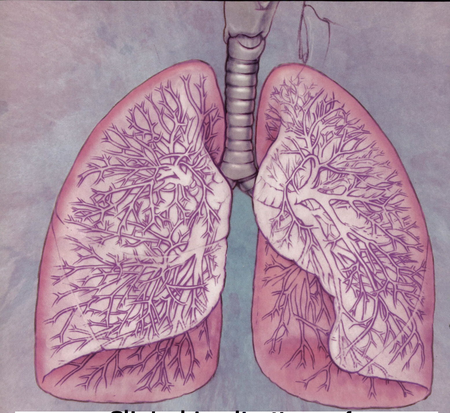 Легкие картинки. Туберкулезный бронхиолит. Поражение органов дыхания. Заболевания дыхательной системы человека.
