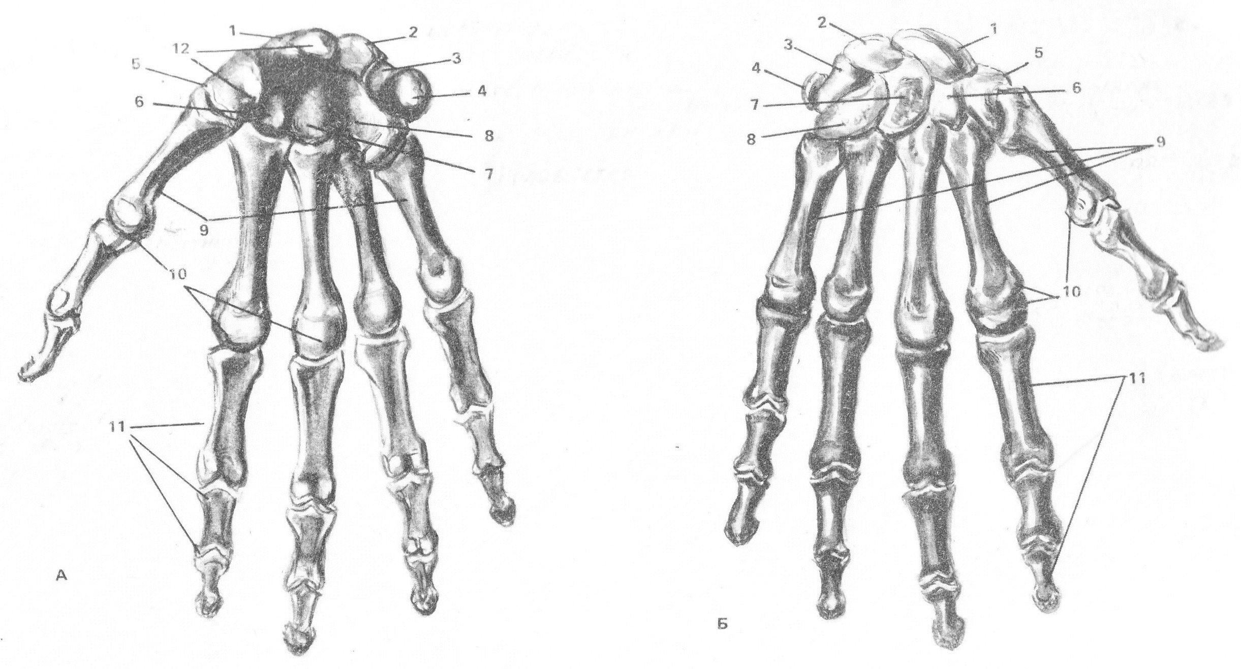 Кости в запястье руки. Кисть руки анатомия кости. Строение костей кисти руки. Кости запястья анатомия человека. Кисть строение анатомия костей.