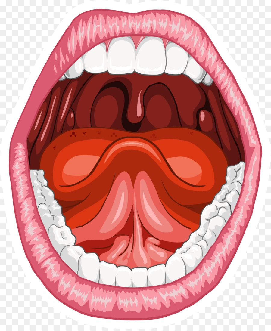 Основные заболевания слизистой оболочки полости рта | Galsi-Dental