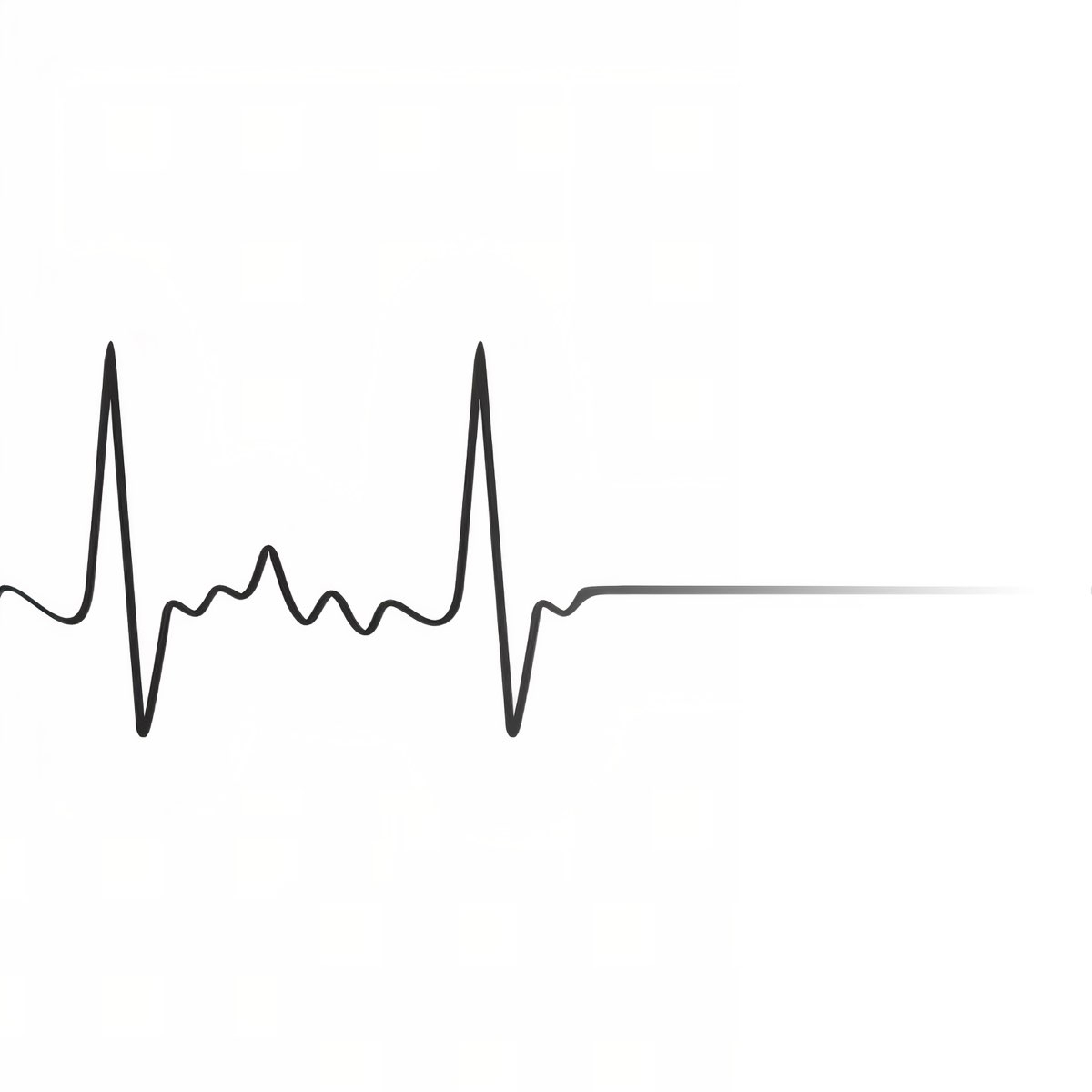 Сердцебиение остановилось. Кардиограмма. Кардиограмма сердца. Линия сердцебиения. Кардиограмма серлце.